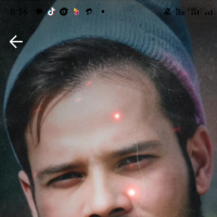 abunasermatubber
